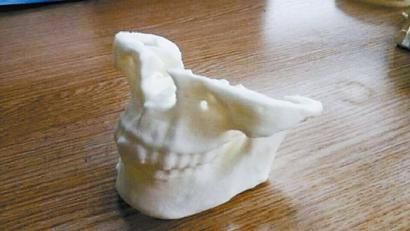 尹稚的公司幫華西口腔醫院列印的頭部骨骼模型。 本文圖片除署名外由受訪者提供