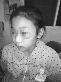 11岁女孩被刀割针扎满身伤警方刑拘养父母(图)